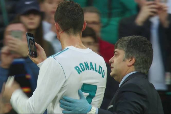 Ronaldo, en mode selfie en plein match pour vérifier sa blessure 